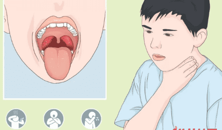喉咙痛发烧怎么办