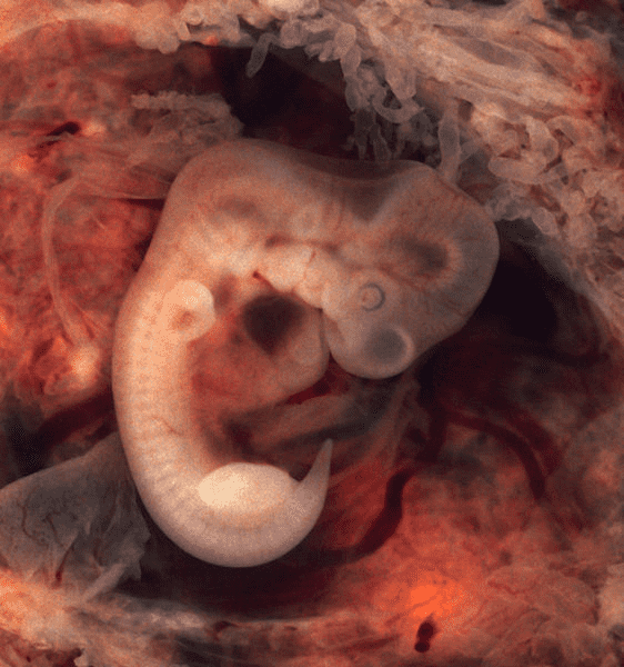 胚胎Embryo